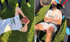 Blessure à l’œil, clés à molette : ce match amateur en Gironde déborde complètement