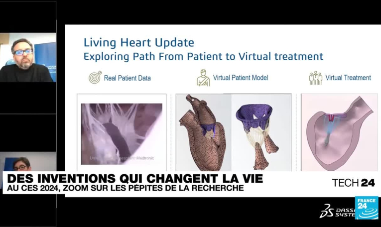 Marcher par la pensée et accompagner les aveugles : ces prouesses qui peuvent changer la vie