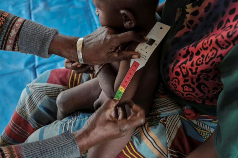 Un agent prend les mensurations d'un jeune enfant au Farne d'Ifotaka, dans le sud de Madagascar, le 24 septembre 2026 ( AFP / Razafindrakoto Mamy Nirina )