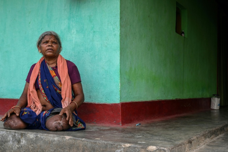 Tama Jogi, qui a perdu ses jambes dans l'explosion d'une mine artisanale, lors d'un entretien avec l'AFP dans le village d'Awapalli du district de Bijapur, dans l'Etat de Chhattisgar, 1er avril 2026 en Inde ( AFP / Shammi MEHRA )