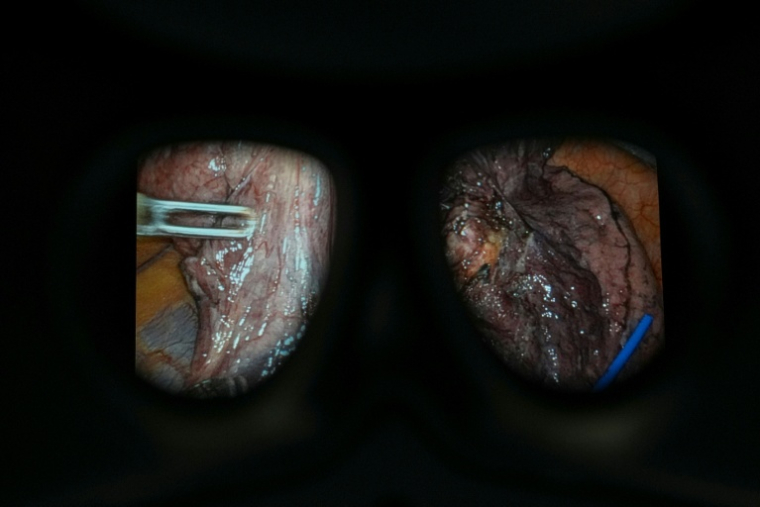 Le gouvernement s'est fixé pour objectif que la chirurgie robot-assistée soit utilisée dans neuf interventions par cœlioscopie sur dix en Angleterre d'ici à 2035 ( AFP / CARLOS JASSO )