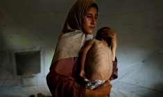 Hidaya, une mère palestinienne de 31 ans, porte son fils malade de 18 mois, Mohammed al-Mutawaq, qui présente des signes de malnutrition, au camp de réfugiés d'Al-Shati, à l'ouest de la ville de Gaza, le 24 juillet 2025 ( AFP / Omar AL-QATTAA )