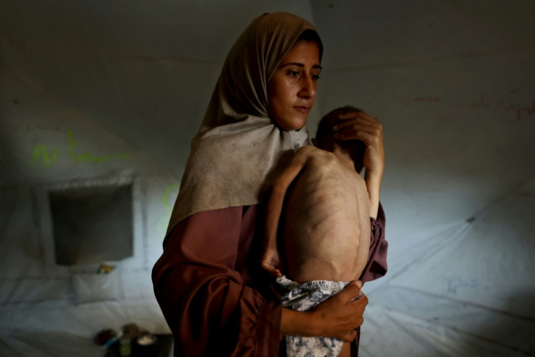 Hidaya, une mère palestinienne de 31 ans, porte son fils malade de 18 mois, Mohammed al-Mutawaq, qui présente des signes de malnutrition, au camp de réfugiés d'Al-Shati, à l'ouest de la ville de Gaza, le 24 juillet 2025 ( AFP / Omar AL-QATTAA )