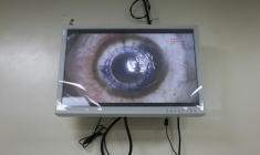 Un écran dans un bloc chirurgical retransmet une greffe de cornée pratiquée à l'hôpital d'ophtalmologie Lions SightFirst à Nairobi le 12 août 2023  ( AFP / Patrick Meinhardt )