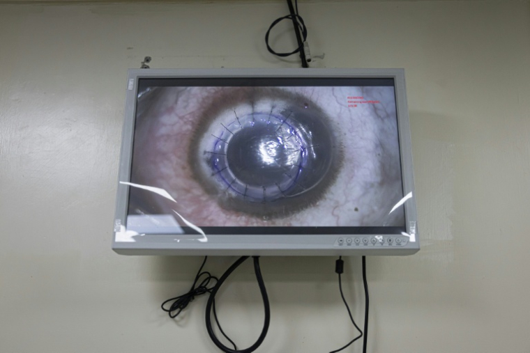 Un écran dans un bloc chirurgical retransmet une greffe de cornée pratiquée à l'hôpital d'ophtalmologie Lions SightFirst à Nairobi le 12 août 2023  ( AFP / Patrick Meinhardt )