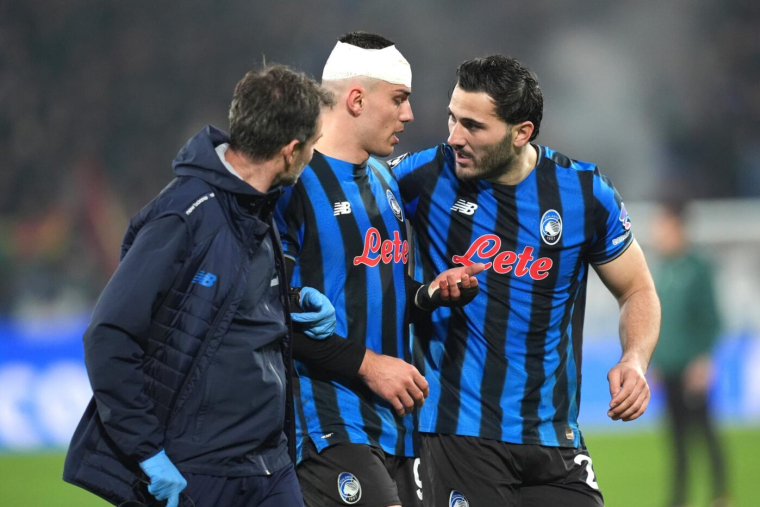 Le visage balafré de Nikola Krstović après le coup de crampons de Ramy Bensebaini