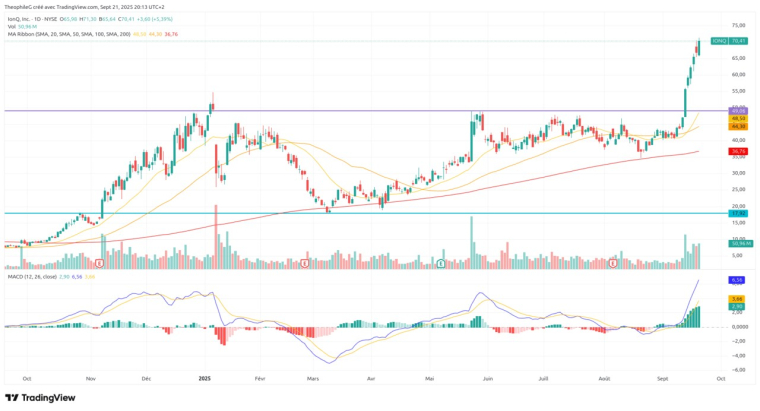 Source : TradingView