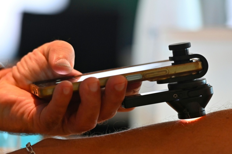 Un kiné utilise un smartphone et un dermascope pour repérer des mélanomes, le 26 septembre 2026, à Montpellier dans l'Hérault ( AFP / Sylvain THOMAS )