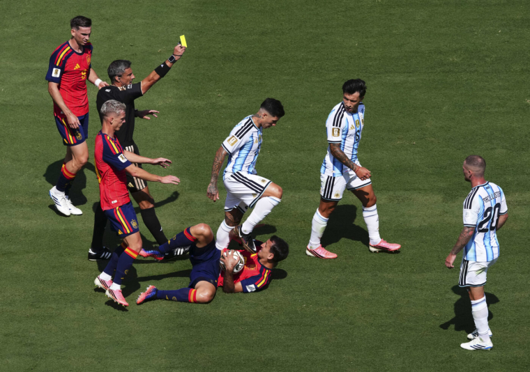 Argentine : il ne faut pas que souffrir pour être bon